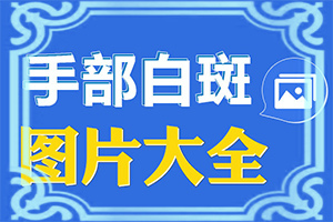 孩子脸上有白点是什么情况