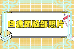 眼睛有白点看东西模糊怎么办