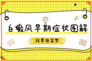 白癜风在兰州安宁区哪家医院治疗比较好