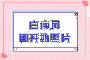 兰州七里河区白癜风医院大概要