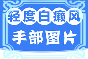 兰州专业看白癜风的医院哪家更好