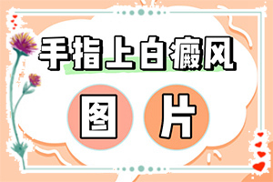 兰州安宁区白癜风治疗专业的医院是哪个