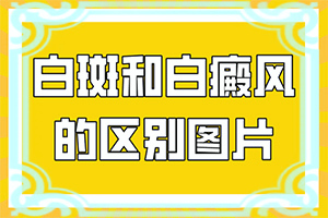 身体上有好多小白点是什么原因怎么治疗