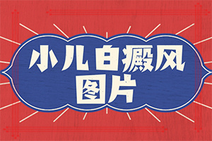 怎样判断得白癫疯[健康要闻]怎样判断是不是白癞风