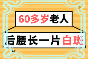 白癞风是怎么引起