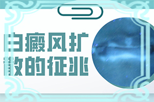 兰州高新区哪里的医院治白癜风较好