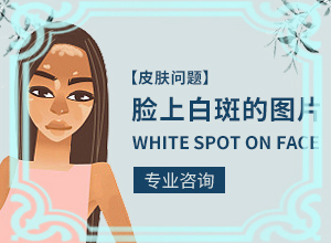 宝宝2个月脸上有白色块是什么原因