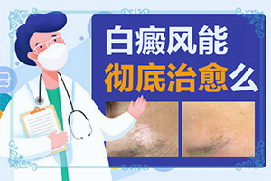 小孩子脸上长白斑是什么原因怎么治疗