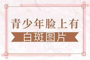 「皮肤科择选」白癜风什么引起的-白癞癜风是什么引起的