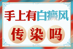 白点癫风前兆图片大全图