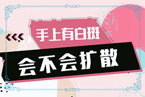 紫外线灯治疗白颠得多久见效