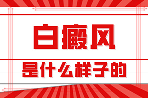 白癞风的初期症状[热点速看]白癞风的初期症状图