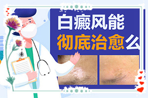 兰州红古区哪个医院哪个治疗白癜风好