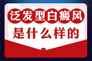 兰州红古区哪个医院是治疗白癜风较好的医院