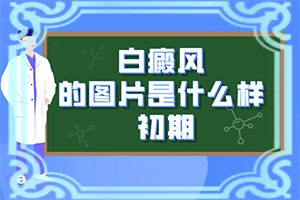 吃什么草药可以治白颠风