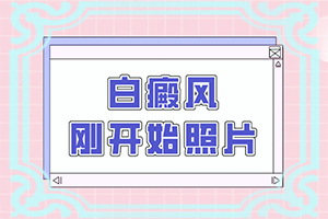 兰州高新区到哪家医院治疗白癜风较专业