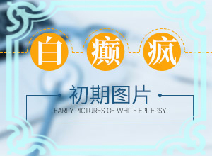 身体长小白点是什么情况