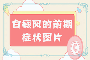 身上皮肤出现白块是什么引起的呢吃什么药