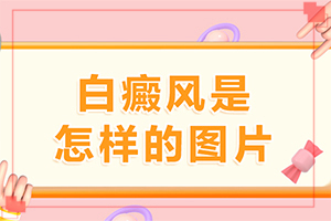 甘肃兰州哪家医院治疗白癜风比较好