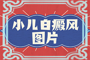 白颠吃药治疗需要忌口什么东西