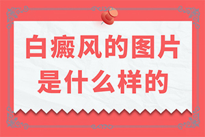 太阳暴晒皮肤起白斑是什么症状图片大全