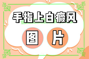 兰州安宁区哪里有治疗白癜风的专科医院