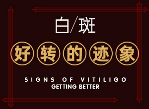 兰州安宁区专门治疗白癜风的医院叫什么