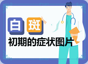 兰州永登县医院治疗白癜风的方式都有哪些