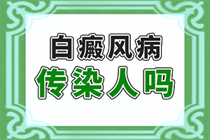 遗传白殿斑早期能治好吗