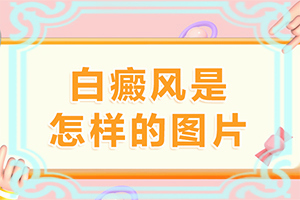 白巅峰早期能治好吗