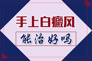 兰州治疗白癜风推荐的医院是哪一家