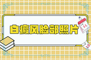 脸上白色的斑是什么原因造成的