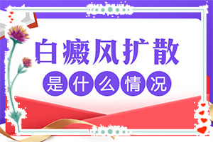 兰州哪个医院看白癜风好还不贵