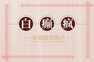 手背突然白一块「实时动态」婴儿头上有白色块