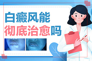 兰州七里河区哪家医院能白癜风