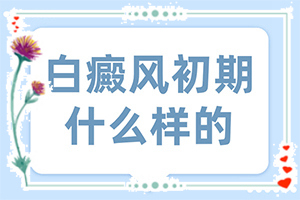 兰州城关区哪个治白癜风的医院好复发吗