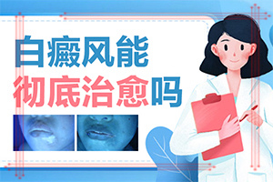 白癜风初期症状[排行榜单]小孩子白颠疯病初期