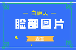 甘肃兰州治疗青少年白癜风哪家医院专业