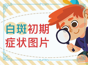 皮肤表面有白色斑点是什么原因图片
