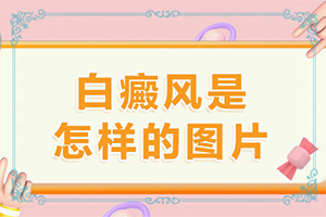 身体出现小白点是什么症状引起的