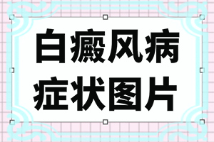 后背长白斑是什么原因引起的图片