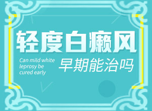 不治疗隐形白颠多久会明显