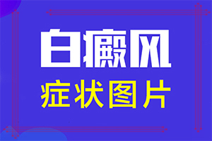 皮肤变一块块的白的「重要发布」白点癫风怎样提高免疫力