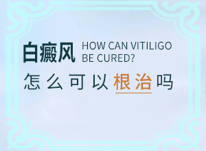 甘肃能把白癜风治疗好的医院哪家好呢