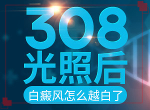 甘肃哪家医院治疗白癜风较好较正规