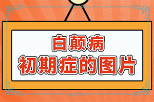 嘴唇上有白色斑是什么原因造成的图片