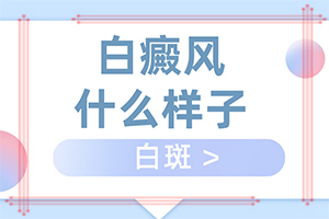 兰州红古区白癜风专科医院到哪里比较好