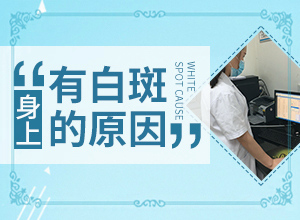 治疗白颠的外用药膏有哪些