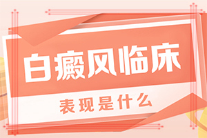 儿童身上长白色斑点「话题中心」轻度白癞风会传染给别人吗