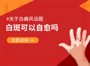 兰州安宁区哪家医院治疗治疗儿童白癜风